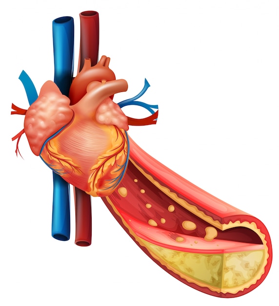 Vector diagram showing human heart and fat veins