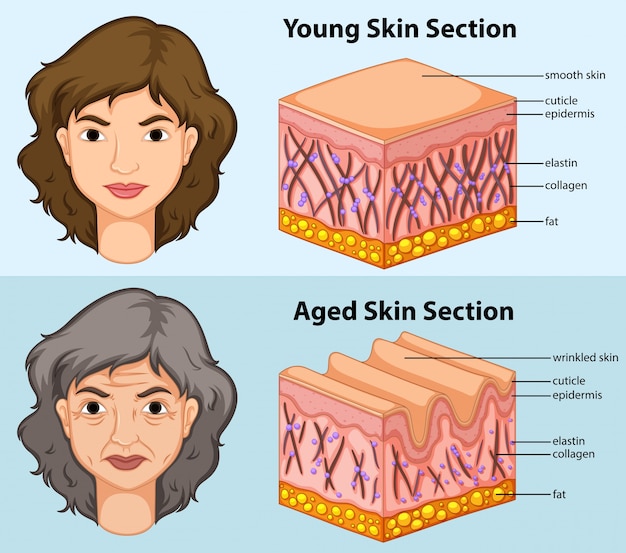 Diagram showing young and aged skin in human