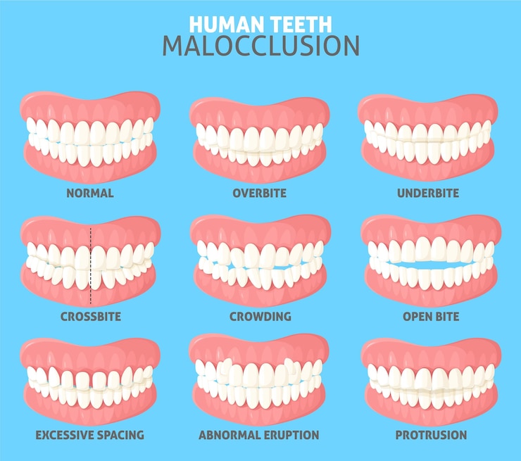 Vector different human teeth malocclusion types front view set