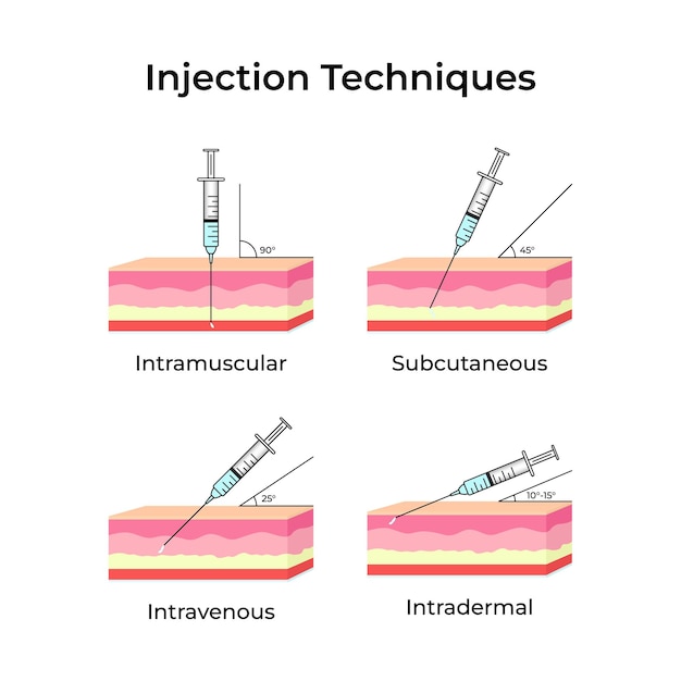 different injection techniques intramuscular subcutaneous intravenous and intradermal