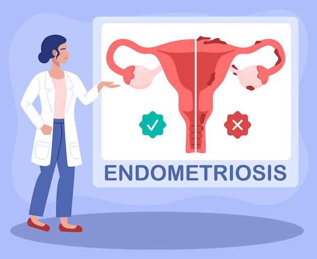 Vector doctor gynecologist talks about endometriosis, uterus and womens health.