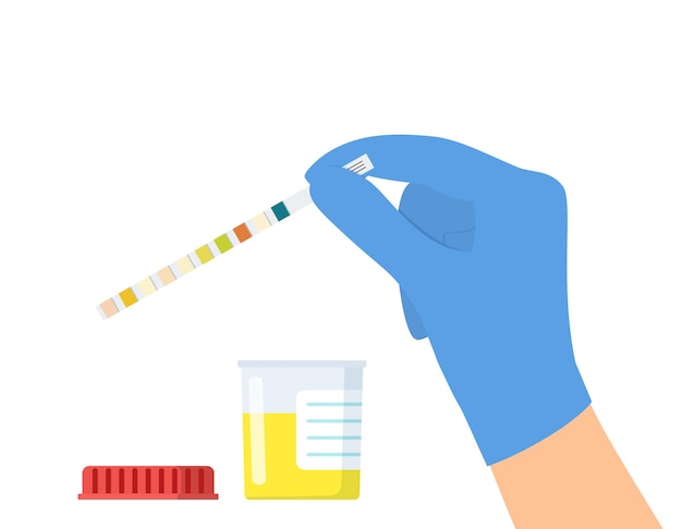 Vector the doctor uses a urine test strip