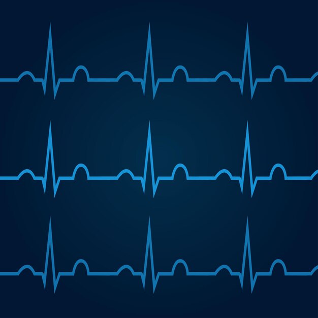 파란색 배경 1의 ECG