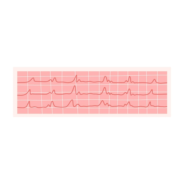 Vector ecg vector illustration electrocardiogram isolated on a white background