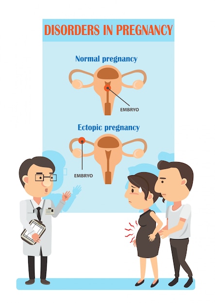 異所性妊娠と正常妊娠の図