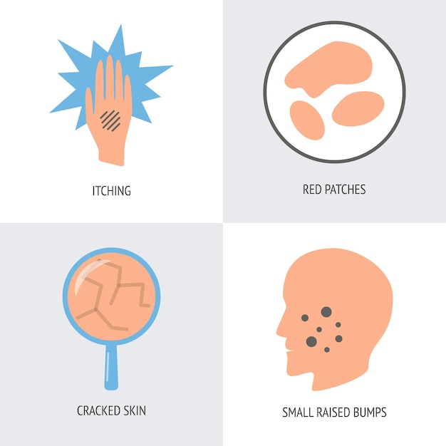 Eczema symptoms icon set