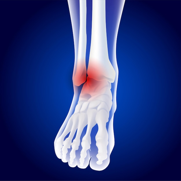 Educational medical illustration of foot bones