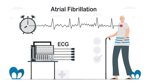 Vector een elektrocardiogram werd gebruikt om het probleem van atriale fibrillatie te analyseren. cardiologie vectorillustratie in vlakke stijl.