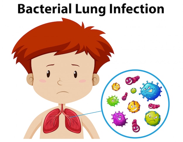 Een jongen bacteriële longinfectie