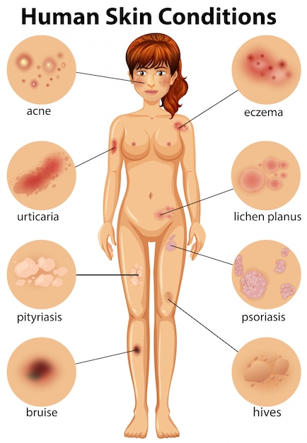 Vector een menselijke anatomie van de toestand van de menselijke huid