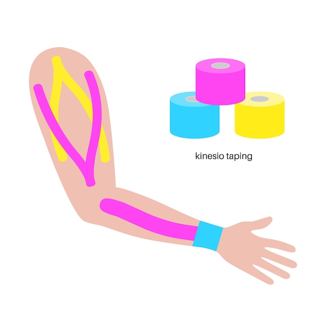 Elastische therapeutische tape Kinesiologische tape op arm KT-methode elastische strip bedoeld om pijn door verwondingen te verlichten Bescherming en fixatie voor schouders, spieren en polsbanden vectorillustratie