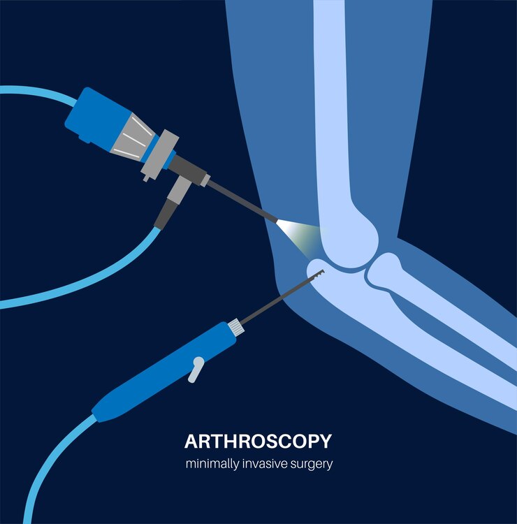 Elbow joint minimally invasive surgery Arthroscopy medical procedure Anatomy of humerus ulna and radius bones Arm pain fracture osteoarthritis or rheumatoid arthritis x ray illustration
