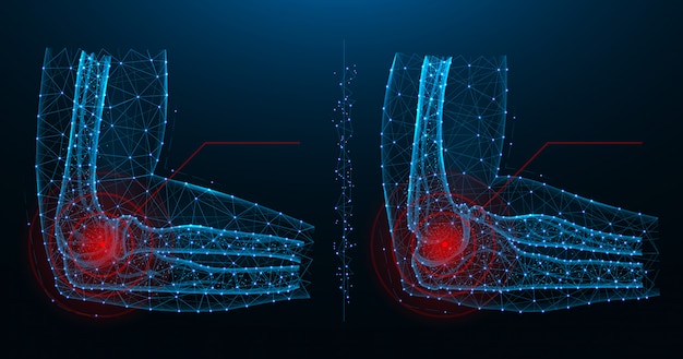 Боль в локтевом суставе синий многоугольный векторные иллюстрации