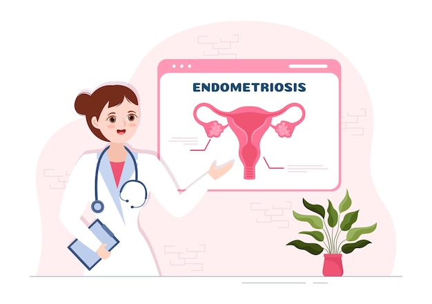 Endometriosis with condition the endometrium grows outside the uterine wall in women in illustration