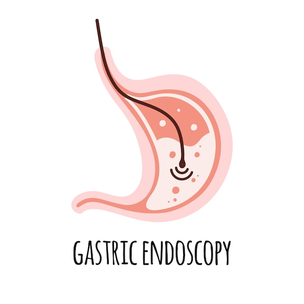 Vector endoscopie de maag van een gezond persoon gastro-enterologie vectorillustratie in een flat