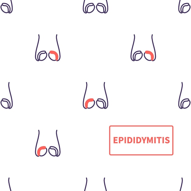 Vector epididymitis disease of testicles anatomy medical pattern