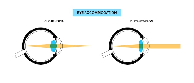 Vector eye accommodation poster