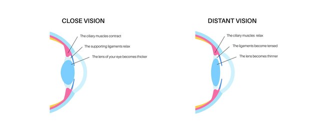 Vector eye accommodation poster