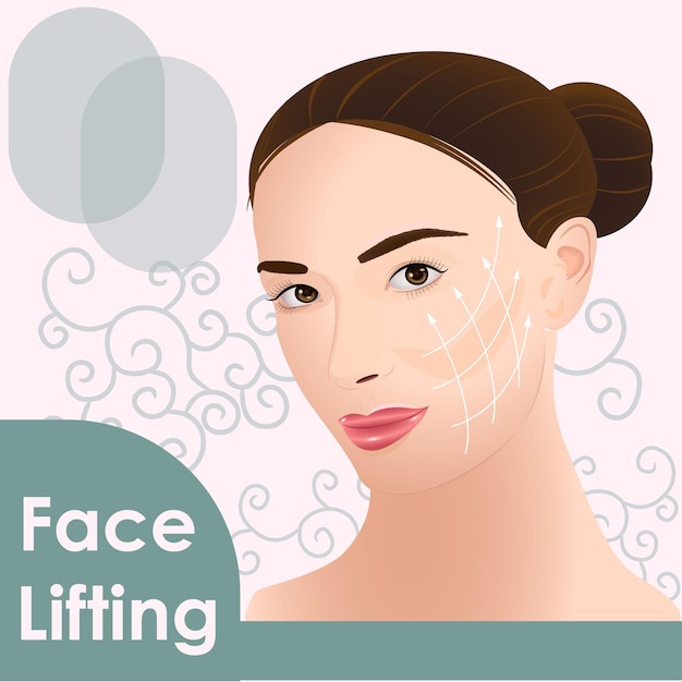 Face lifting