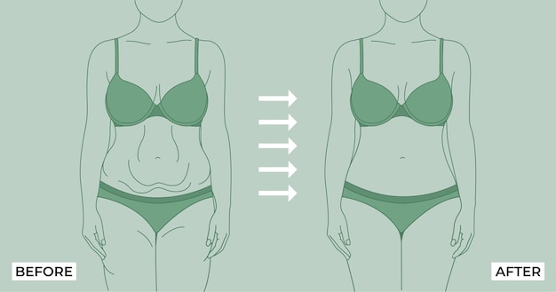 Fat To Fit. Before and after weight loss fat and slim woman on a Light background.