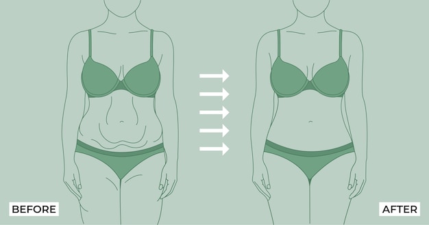 Fat To Fit. Before and after weight loss fat and slim woman on a Light background.