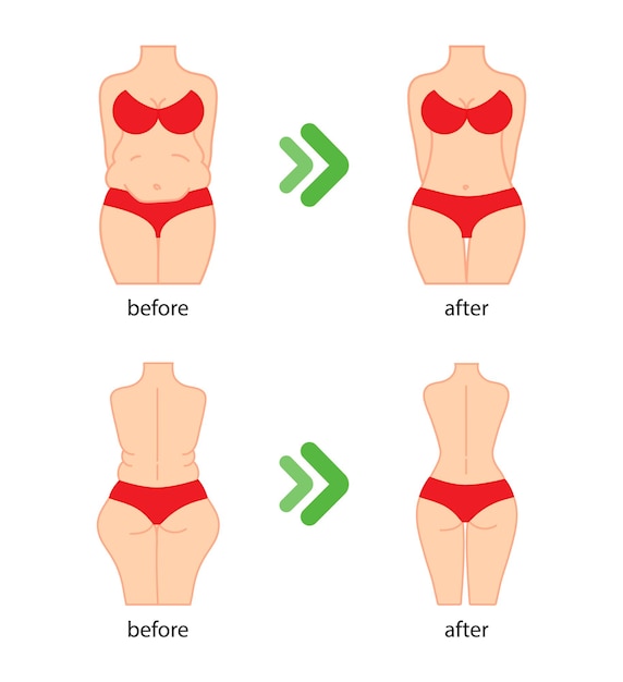 Vector fat and slim woman figure before and after diet fitness or liposuction