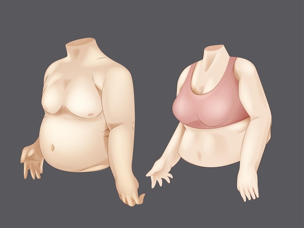 Жирная концепция тела мужчины и женщины нездоровая форма избыточного веса формирует реалистичную векторную иллюстрацию