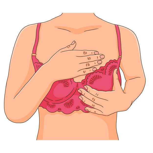 Healthy breast and changes in nipple shape, illustration - Stock Image -  F033/1525 - Science Photo Library