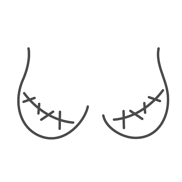 Illustrazione del doodle della linea di rimozione della ghiandola mammaria del seno femminile problema di salute delle donne vettore