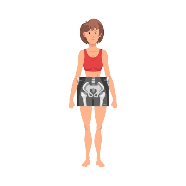 Ossa della coscia femminile vista anteriore illustrazione vettoriale a radiografia concepto di procedura radiografica