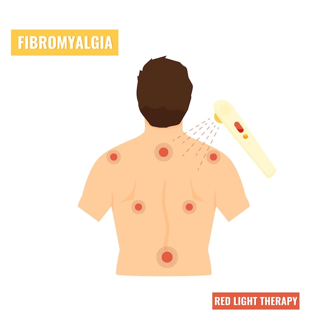 Fibromyalgia disease Red light therapy