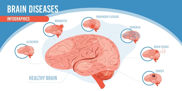벡터 플랫 만화 infographic, 건강한 뇌