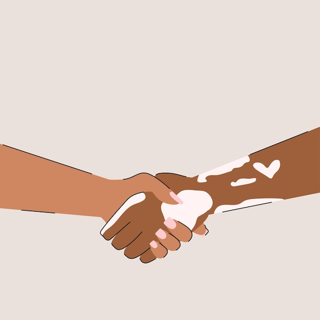 Illustrazione vettoriale piatta stretta di mano supporta le persone con malattia di vitiligine
