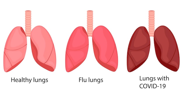 Грипп легких, covid-19, здоров. изменение цвета легких при болезни. иллюстрация в мультяшном стиле.
