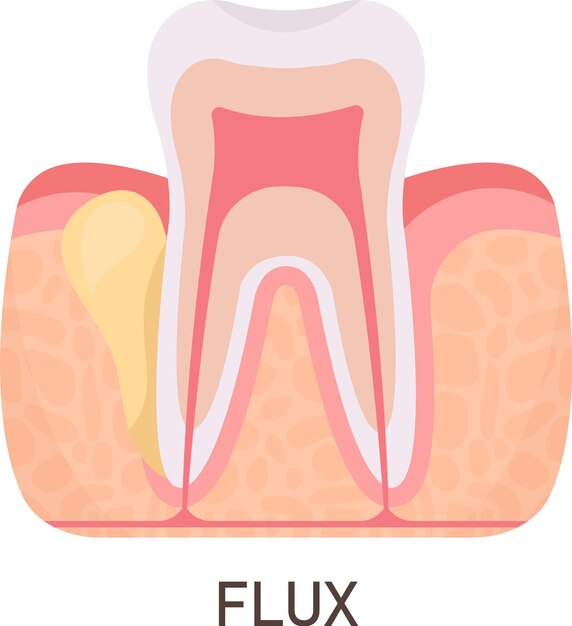 Проблема с флюсом зуба