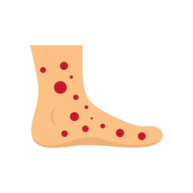 Vector foot measles icon flat illustration of foot measles vector icon for web design