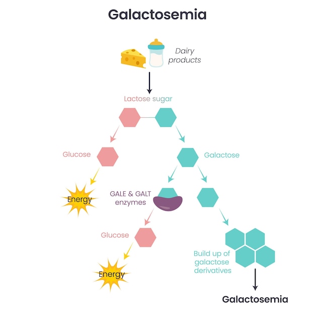 Vector galactosemia gale galt enzyme deficiency science vector illustration infographic