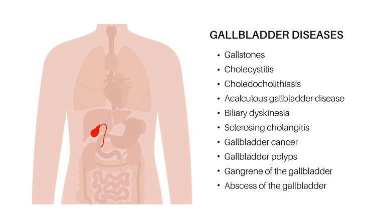 Vector gallbladder anatomy poster