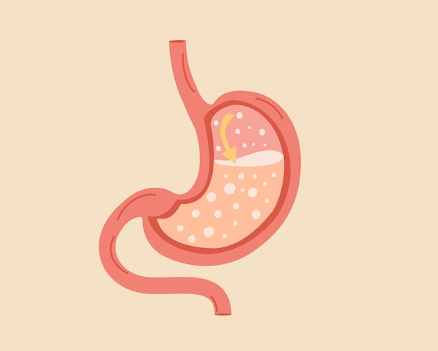 Gastritis en zure reflux indigestie en maagpijn Gezond voedsel voedingsconcept