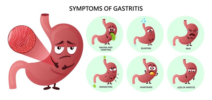 Vector gastritis symptoms infographic with cartoon stomach characters