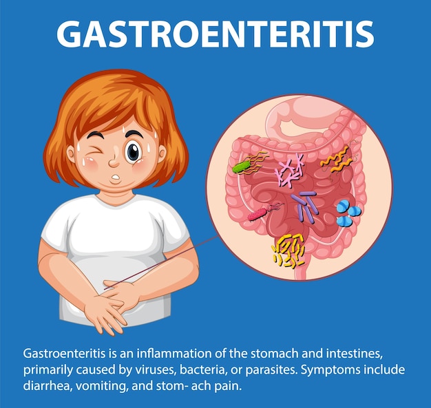 Vettore sintomi della gastroenterite e illustrazione dell'infezione dell'apparato digerente