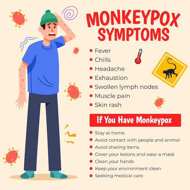 Vector general monkeypox symptoms information