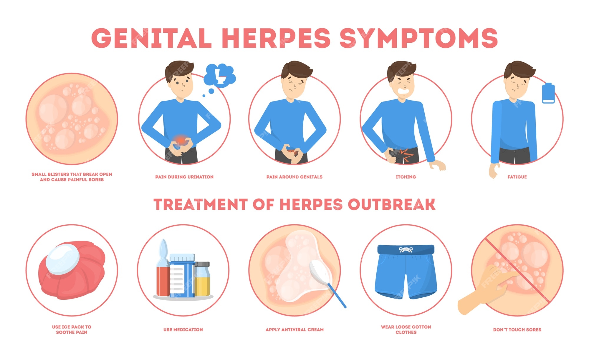 Premium Vector Genital Herpes Symptoms Infectious Dermatology Disease Illustration