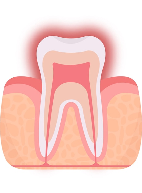 Vector gevoelig tandprobleem