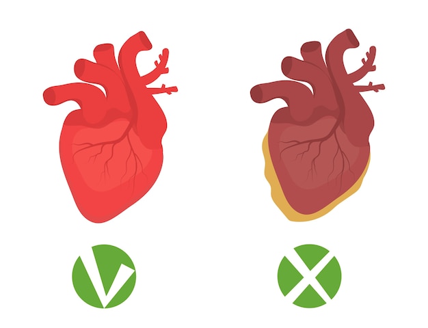 Vector gezond hart en ongezonde hart vette infographics.