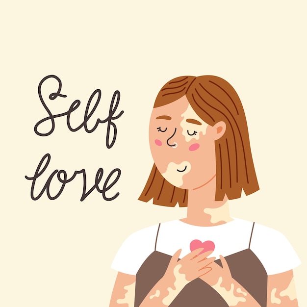 Vector girl with vitiligo accepts herself. body positive, self love, depigmentation disease, accepting your body. international 
 vitiligo day. modern vector illustration in flat hand drawn style