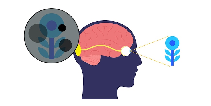 Vector glaucoma eye disease