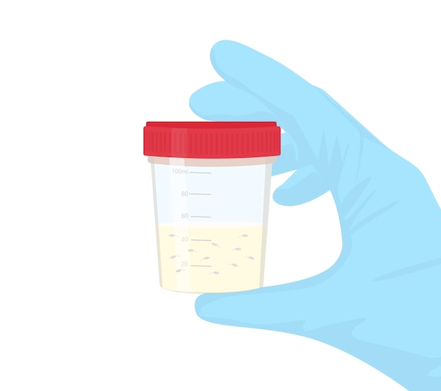 Gloved hand holding a plastic jar with sperm for semen analysis Semen Test Tube in Hand Vector illustration