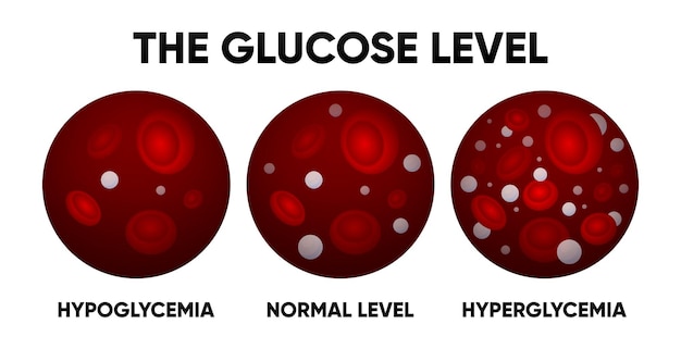 Vector glucose in the blood vessel normal levels hyperglycemia hypoglycemia normal high and low blood sugar