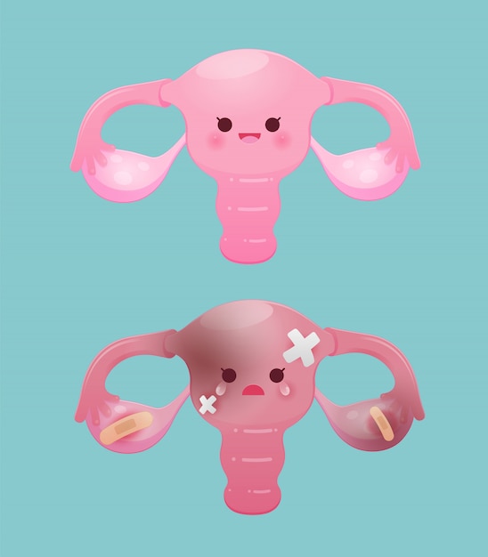 Good uterus and bad uterus,  flat character illustration design